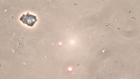 Amoeba 3b